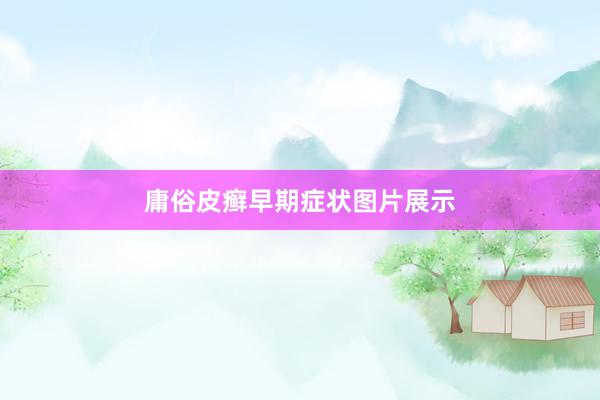 庸俗皮癣早期症状图片展示